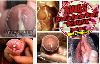 Illustration for article titled Cara Mengatasi Penis Mengeluarkan Sedikit Nanah